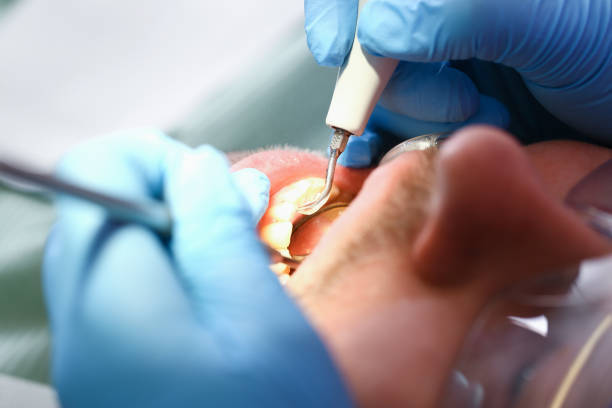 Best Emergency Treatment for Toothache in Gearhart, OR